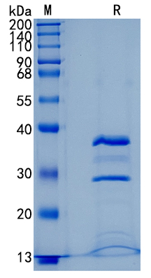 Active Recombinant Human Cathepsin S / CTSS Protein