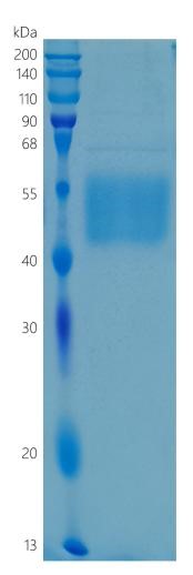 Active Recombinant Human IL-3R alpha / CD123 Protein