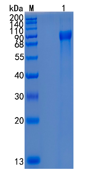 Active Recombinant Human GRN / Granulin / PCDGF Protein