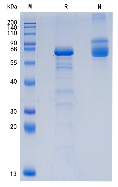 Active Recombinant Human Proprotein Convertase 1 / PCSK1 Protein