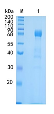 Active Recombinant Human EphA3 / Eph receptor A3 Protein