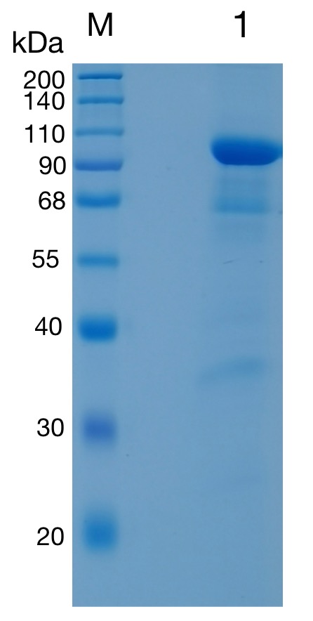 Active Recombinant Human EphA8 / Eph receptor A8 Protein