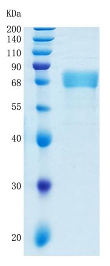 Active Recombinant Human IL-12A / IL-12 p35 Protein