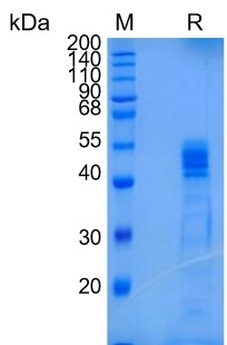 Active Recombinant Human IL-12B / IL-12 p40 Protein