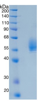 Active Recombinant Human Serpin B3 / SCCA-1 Protein