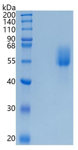 Active Recombinant Human CD66b / CEACAM8 Protein