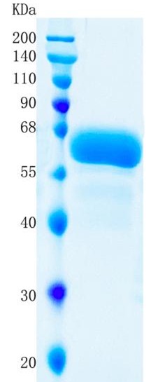 Active Recombinant Human IL-3R beta / CD131 / CSF2RB Protein