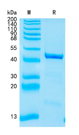 Active Recombinant Human ICAM-3 / CD50 Protein