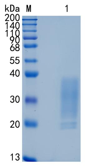 Active Recombinant Human CD30 Ligand / CD153 / TNFSF8 Protein