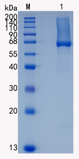 Active Recombinant Human Glypican-1 / GPC1 Protein