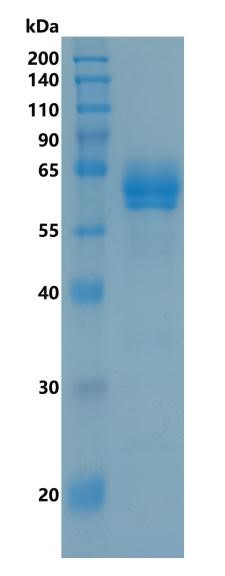 Active Recombinant Human LTBR / TNFRSF3 / CD18 Protein