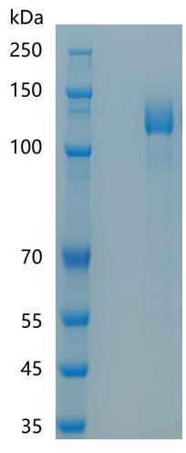 Active Recombinant Human gp130 / CD130 / IL-6ST Protein
