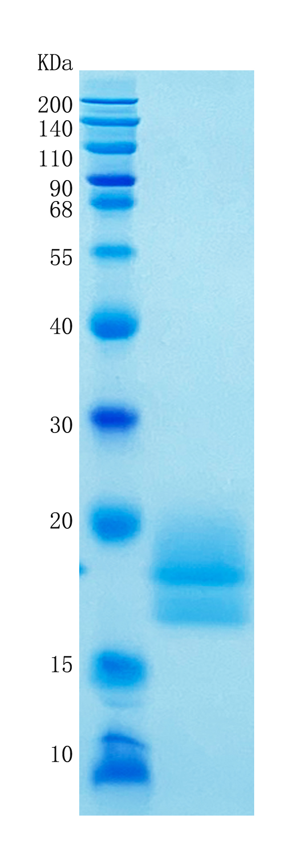Active Recombinant Human CEACAM3 / CD66d Protein