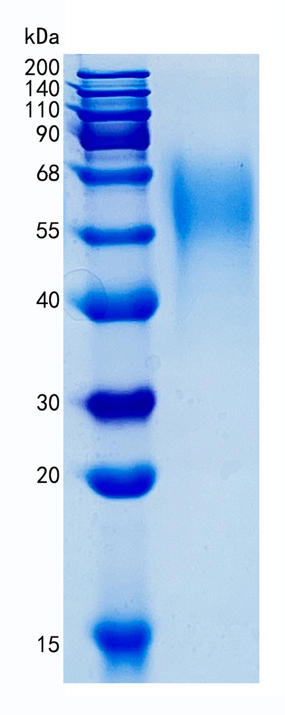 Active Recombinant Human CEACAM6 / CD66c Protein