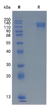Active Recombinant Human LIFR / CD118 Protein