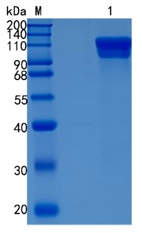 Active Recombinant Human ECE1 / Endothelin-converting enzyme 1 Protein