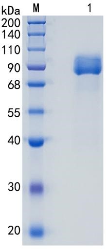 Active Recombinant Human AFM / Afamin / Alpha-albumin Protein