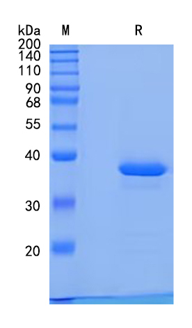Active Recombinant Mouse IGFBP-2 Protein