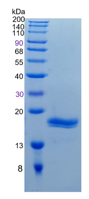 Active Recombinant Human REG1B / PSP / PSP-I Protein