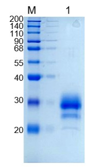 Active Recombinant Human TFPI2 / Placental protein 5 Protein