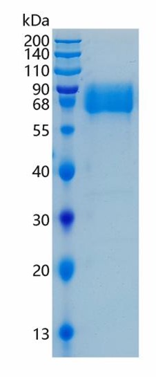 Active Recombinant Human IFNAR2 / Interferon alpha / beta Receptor 2 Protein