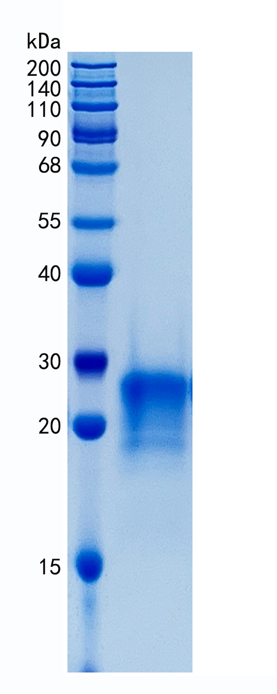 Active Recombinant Human PlGF / PGF / Placental Growth Factor Protein