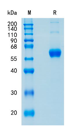 Active Recombinant Mouse Flt3 Ligand / FLT3L Protein