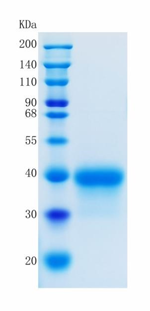 Active Recombinant Human Ephrin-A3 / EFNA3 Protein