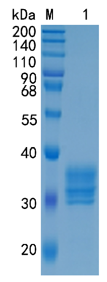 Active Recombinant Human Stanniocalcin 1 / STC1 Protein