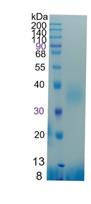 Active Recombinant Mouse Oncostatin M / OSM Protein