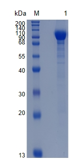 Active Recombinant Human K-Cadherin / CDH6 Protein