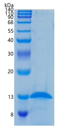 Active Recombinant Human beta-2-Microglobulin / B2M Protein