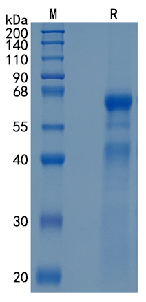 Active Recombinant Human ADAM8 / CD156a Protein (BSA and azide free)
