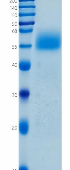 Active Recombinant Human IL-13 R alpha 1 / CD213a1 Protein