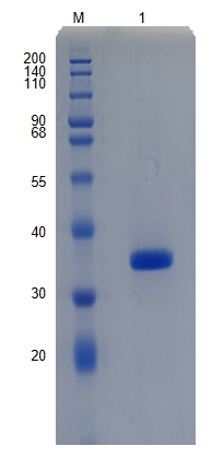 Active Recombinant Mouse sFRP-2 / SFRP2 Protein