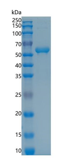 Active Recombinant Mouse RANKL / TNFSF11 / TRANCE Protein
