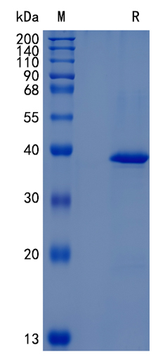 Active Recombinant Mouse sFRP-3 / FrzB Protein