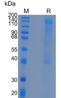 Active Recombinant Human Enterokinase / TMPRSS15 Protein
