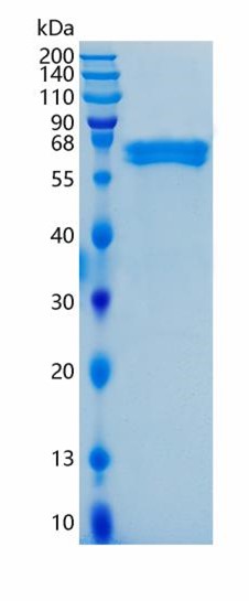 Active Recombinant Human Ephrin-B1 / EFNB1 Protein