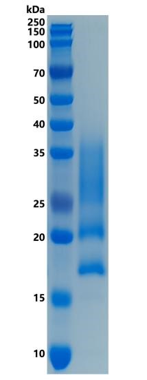 Active Recombinant Human CD83 Protein