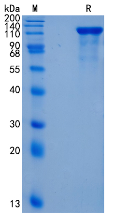 Active Recombinant Human TAG1 / TAX1 Protein