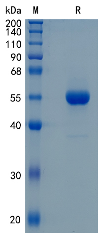 Active Recombinant Human GCNT1 / C2GnT Protein