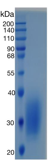 Active Recombinant Human PTH1R / Parathyroid Hormone Receptor 1 Protein