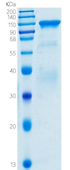 Active Recombinant Human HGFAC / Hepatocyte Growth Factor Activator Protein