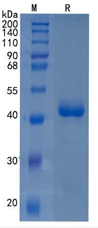 Active Recombinant Human Activin RIA / ALK-2 / ACVR1 Protein