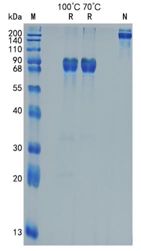 Active Recombinant Human TRAIL R3 / TNFRSF10C / CD263 Protein