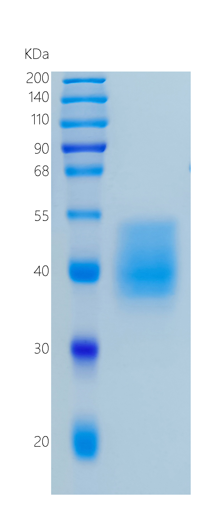 Active Recombinant Human IL-10R beta / CD210b Protein