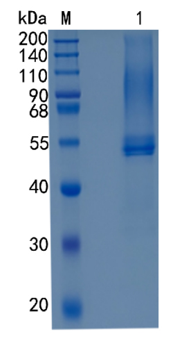 Active Recombinant Human Testican-1 / SPOCK1 Protein
