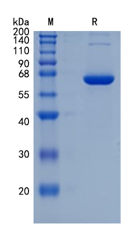 Active Recombinant Human FGL1 / Hepassocin / HP Protein