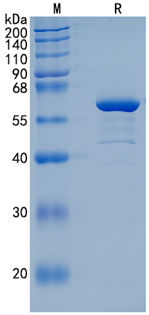 Active Recombinant Human GALNT2 / Polypeptide GalNAc Transferase 2 Protein